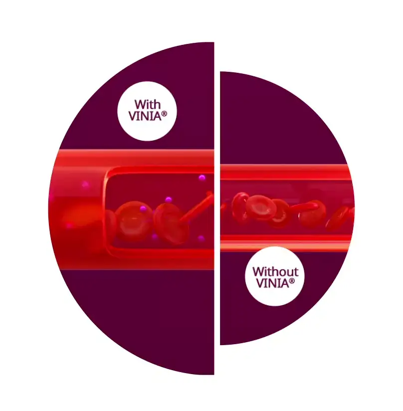 VINIA Blood Flow Comparison